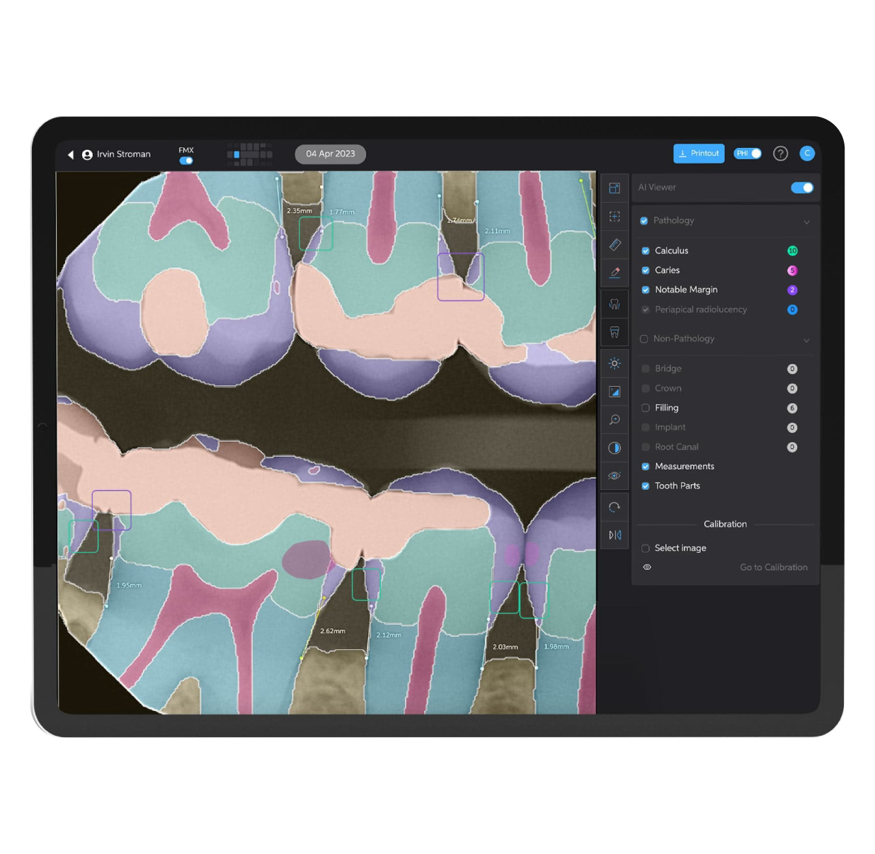 Native Dental Imaging on iPad